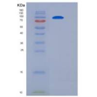 人Insulin Receptor / INSR / CD220重组蛋白short isoform, His tag