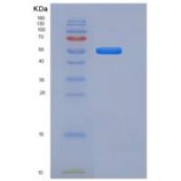 人FGFR1 / CD331重组蛋白His & Fc tag