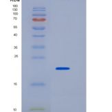 小鼠CD32 / FCGR2B重组蛋白His tag