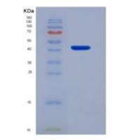 小鼠FCGRT & B2M Heterodimer重组蛋白