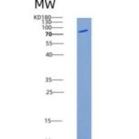 人IL27Ra / TCCR / WSX重组蛋白Fc tag