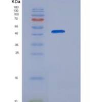 人半乳糖苷酶α(GLa)重组蛋白His tag