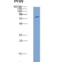 人唾液酸乙酰酯酶(SIAE)重组蛋白His tag