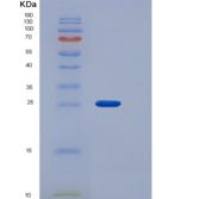 小鼠MCPT1重组蛋白His tag