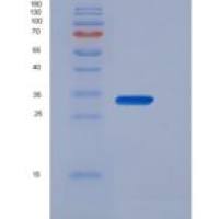 小鼠Fc Î³ RI/FCGR1A/CD64重组蛋白C-6His