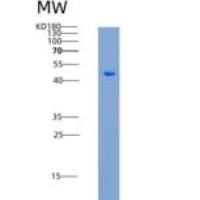 大鼠MSR1 / SCARA1重组蛋白His tag