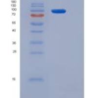 人Insulin Receptor / INSR / CD220重组蛋白long isoform, His tag