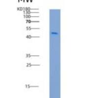 人芳基硫酸酯酶A(ARSA)重组蛋白His tag