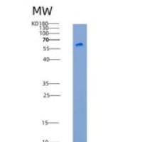 人AMY2A / Alpha-amylase重组蛋白His tag