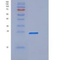 小鼠CD32 / FCGR2B重组蛋白His & AVI tag, Biotinylated