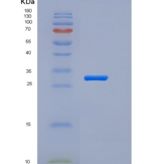 人Pancreasin / Marapsin / PRSS27重组蛋白His tag