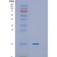 人TrkA / NTRK1重组蛋白aa 285-413, His tag