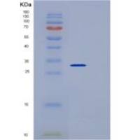 小鼠CD64 / FCGR重组蛋白His tag