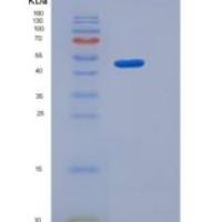 大鼠B7-H3 / CD276重组蛋白Fc tag