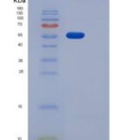 人PDGFRa / CD140a重组蛋白His tag