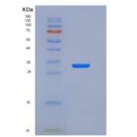 人嘌呤核苷磷酸化酶(PNP)重组蛋白His tag