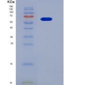 人成纤维细胞生长因子受体4(FGFR4)重组蛋白Fc tag