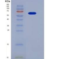 人成纤维细胞生长因子受体4(FGFR4)重组蛋白Fc tag