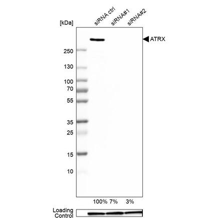 Anti-ATRX/抗ATRX抗体