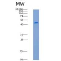 大鼠SerpinA1重组蛋白His Tag