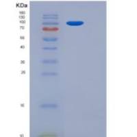 大鼠ENPEP / Aminopeptidase A重组蛋白aa 41-945, His tag