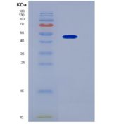 小鼠CD200受体1(CD200R1)重组蛋白His & Fc tag