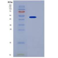 小鼠CD200受体1(CD200R1)重组蛋白His & Fc tag