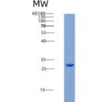 人CD24分子(CD24)重组蛋白Fc tag