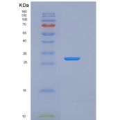 人XIAP / BIRC4重组蛋白AVI tag
