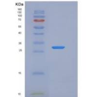 人XIAP / BIRC4重组蛋白AVI tag