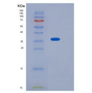 小鼠SFTPD / SP-D / SFTP4重组蛋白His 