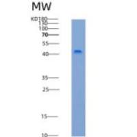 小鼠激活素A受体ⅡB(ACVR2B)重组蛋白His & Fc tag
