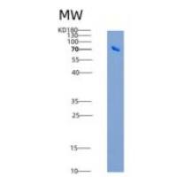 人Nogo Receptor / NOGOR / RTN4R重组蛋白His & Fc tag