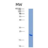小鼠再生胰岛衍生蛋白3α(REG3a)重组蛋白His tag