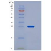 小鼠FOLR1 / FR-alpha重组蛋白His tag