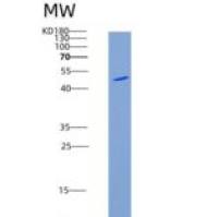 小鼠KIRREL1 / NEPH1重组蛋白His tag