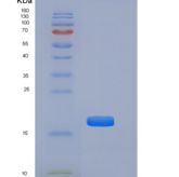 小鼠TNFRSF19 / TROY重组蛋白His tag