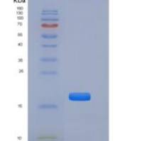 小鼠TNFRSF19 / TROY重组蛋白His tag