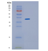大鼠CD5分子(CD5)重组蛋白His tag