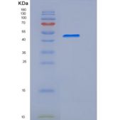 小鼠CD33 / Siglec-3重组蛋白Fc tag