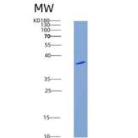 人Podoplanin / PDPN重组蛋白His & Fc tag