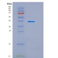 小鼠SIRP alpha / CD172a重组蛋白His tag
