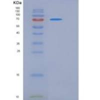 大鼠CLP1 / COLEC12重组蛋白His tag