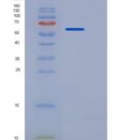 大鼠CD5分子(CD5)重组蛋白Fc tag