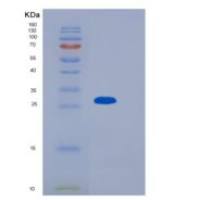 小鼠激肽释放酶1(KLK1)重组蛋白His tag