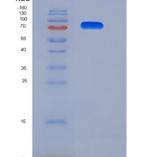 小鼠TLR3 / CD283重组蛋白His tag