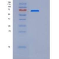 大鼠Toll样受体2(TLR2)重组蛋白His tag