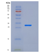 人Pancreasin / Marapsin / PRSS2