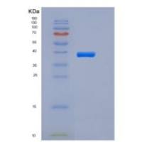 人LRPAP1 / A2MRAP重组蛋白His tag