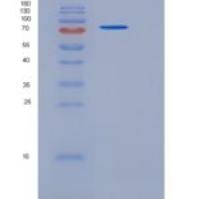 人PDGFRa / CD140a重组蛋白Fc tag